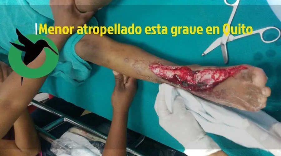 Menor es atropellado por una Cordero Guerra
