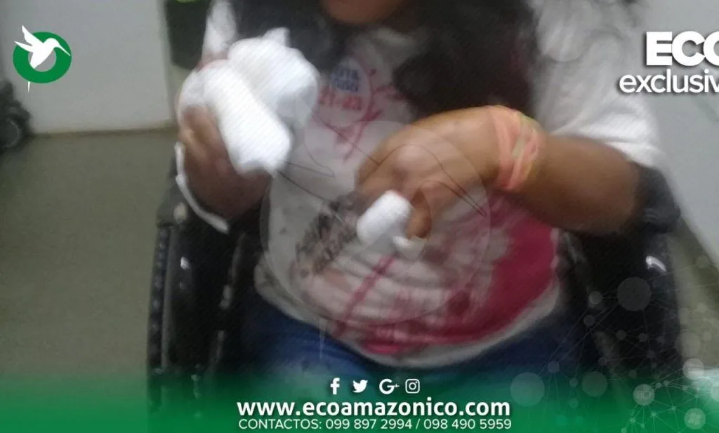 Mujer agredida a machetazos en Puyo la Tarqui