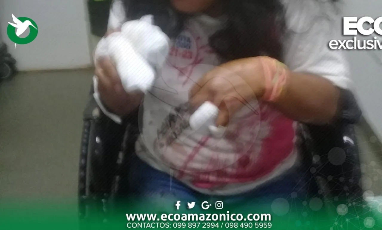 Mujer agredida a machetazos en Puyo la Tarqui