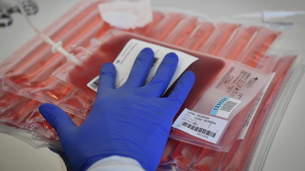 Descubren material genético que impide que las células cancerosas formen metástasis