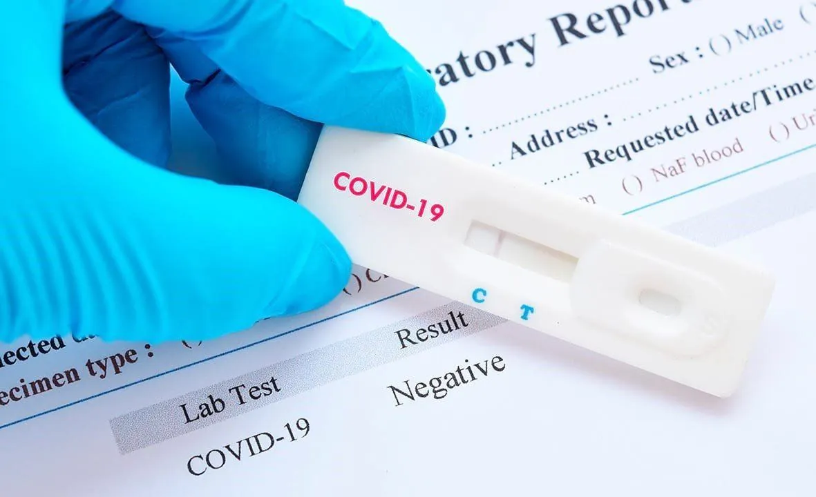 Pruebas rápidas del Covid-19 no son confiables según los expertos