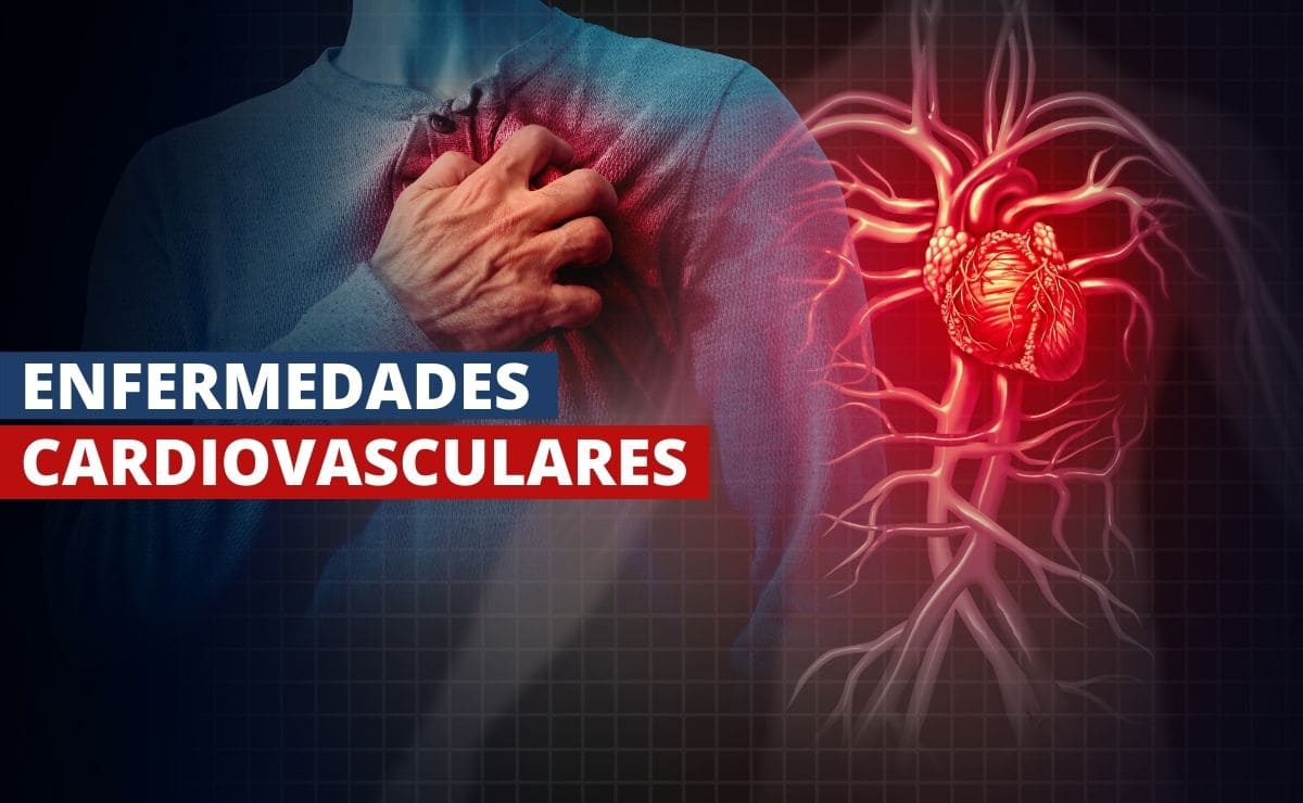 Prevención de enfermedades cardiovasculares