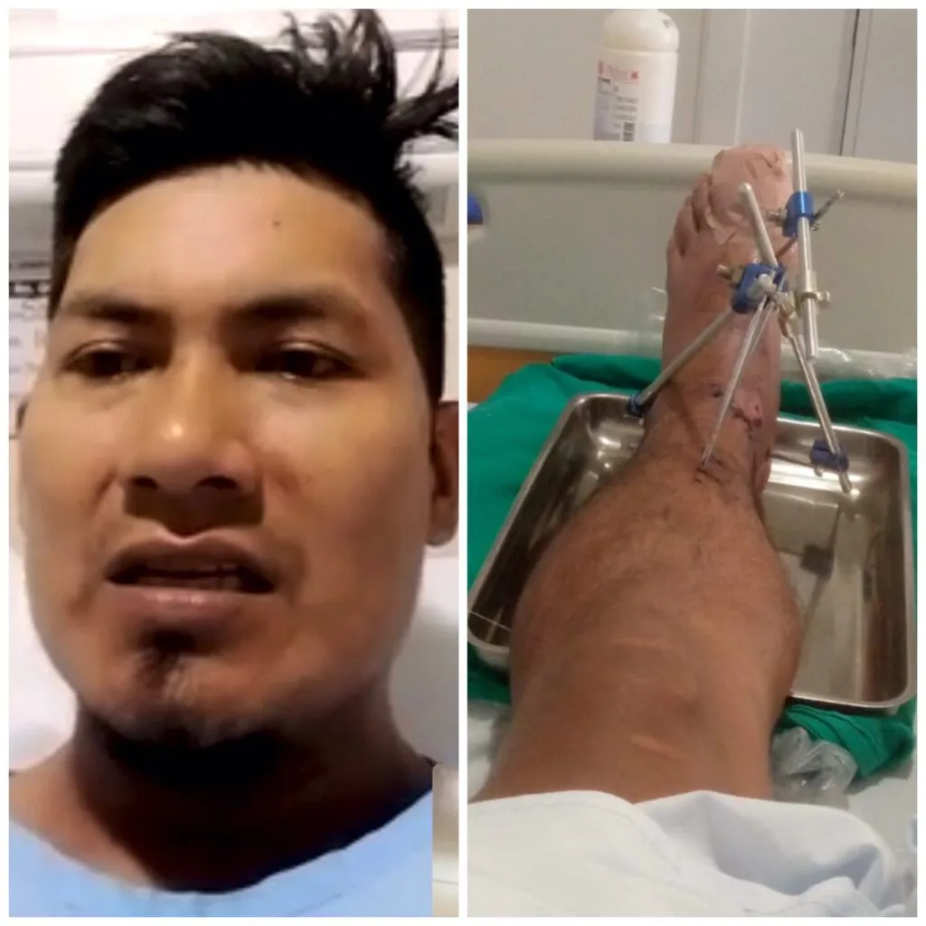 Hombre herido en accidente en Guagrayaku hace un llamado a conductor responsable