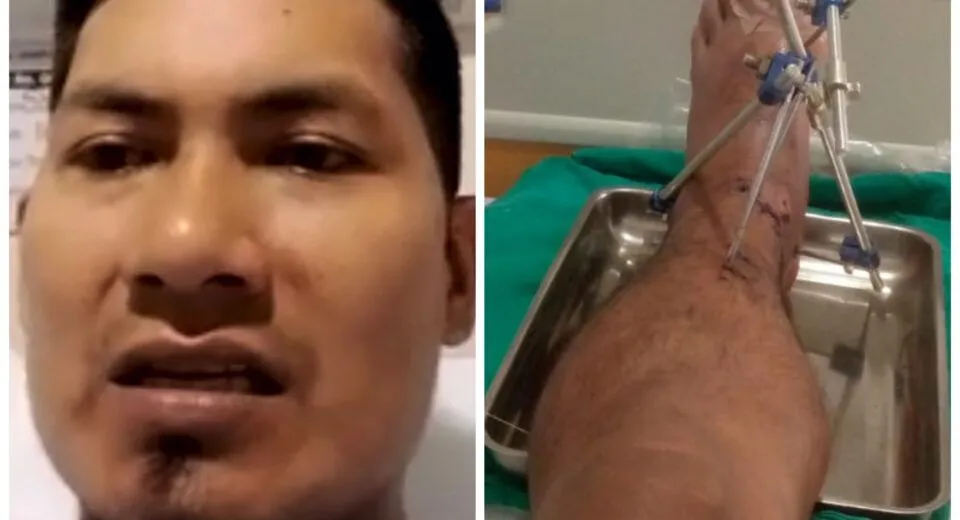 Hombre herido en accidente en Guagrayaku hace un llamado a conductor responsable