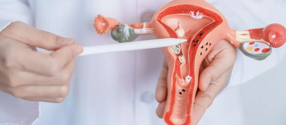 Conferencia de Prevención del Cáncer del Cuello Uterino en Puyo